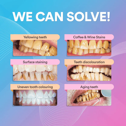 V34 Pro Smile Removal Plaque Stain Purple Corrector Teeth Whitening Toothpaste Enamel Care Easy Reduce Yellowing Oral Clean Care